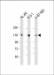 DEPDC5 Antibody (C-term)